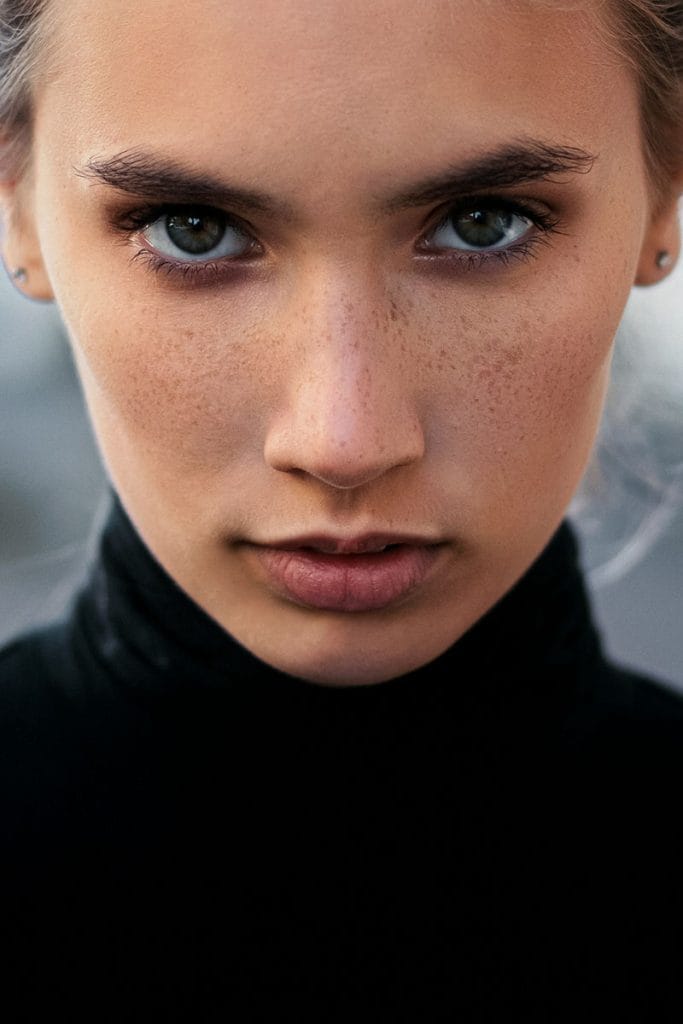 A woman with defined facial contours often seen in results from a buccal fat removal with Dr. Randall in Morristown, NJ