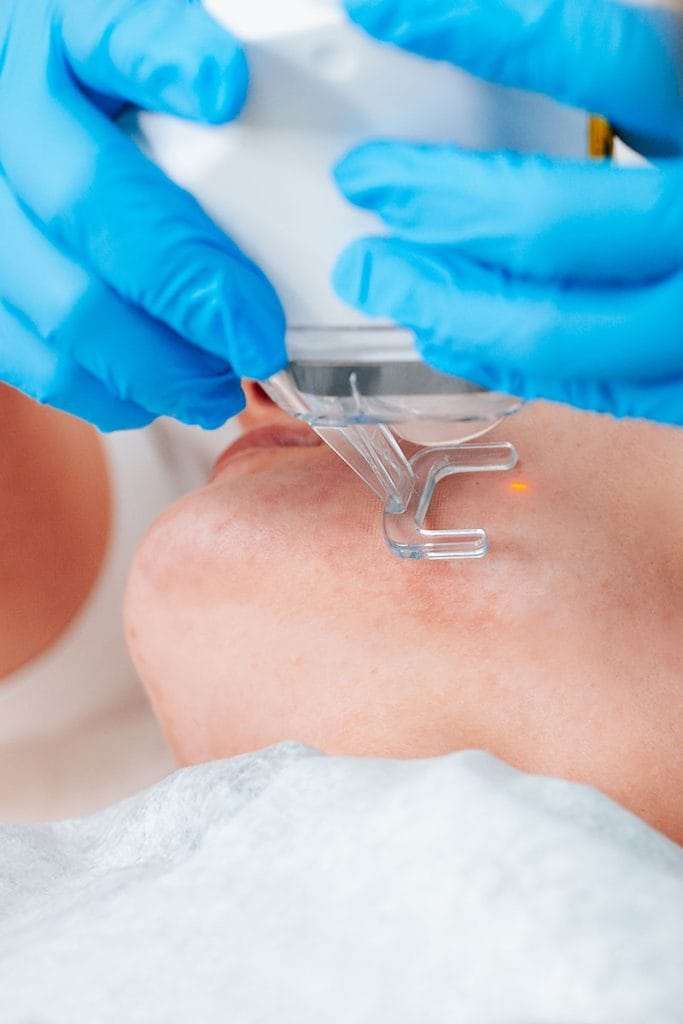 An example of what laser resurfacing would look like with Dr. Randall in Morristown, NJ